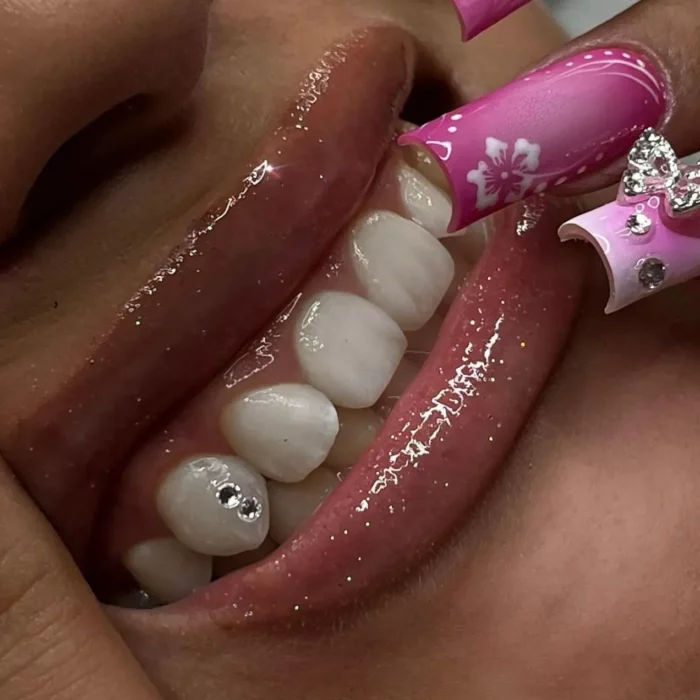 Nahaufnahme des Mundes einer lächelnden Person mit glänzenden Lippen und drei Strasssteinen auf den unteren Zähnen. Die Person hat rosa Nagelkunst mit Blumenmuster auf den Fingern, die die Lippen berühren.