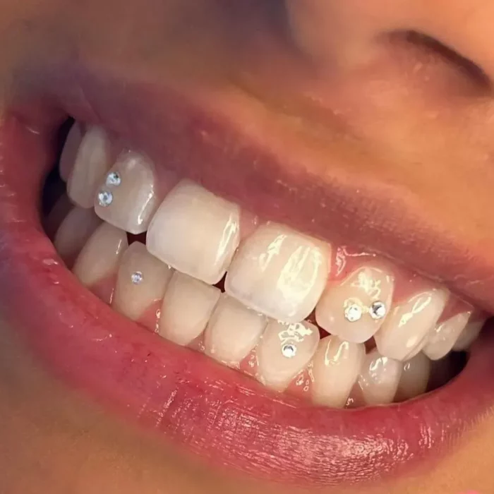 Nahaufnahme des Lächelns einer Person, die weiße Zähne zeigt, die mit kleinen, funkelnden Edelsteinen geschmückt sind. Die Lippen sind leicht geöffnet und geben den Blick auf die Vorderzähne frei, an denen die Edelsteine befestigt sind. Das Bild konzentriert sich auf die Zahndekoration.