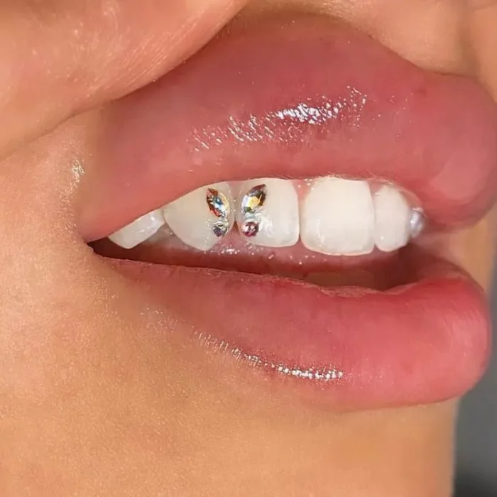 Nahaufnahme eines Lächelns, das glänzende Lippen und sichtbare Zähne zeigt. An zwei Vorderzähnen sind schmetterlingsförmige Juwelen befestigt. Der Hautton ist hellbraun und die Beleuchtung hebt die glänzende Textur der Lippen und das Funkeln der Juwelen hervor.